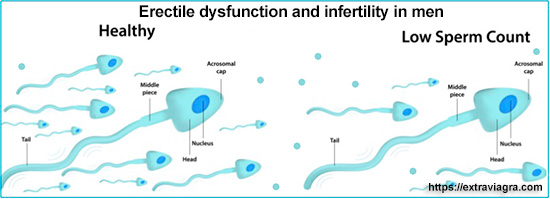 erectile dysfunction and infertility in men