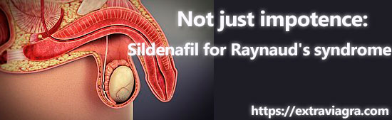 Sildenafil for Raynaud's syndrome